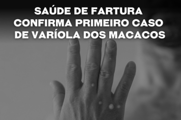 Saúde de Fartura confirma caso de varíola dos macacos